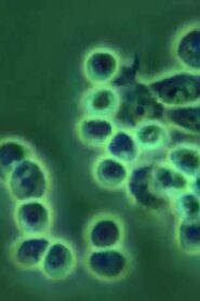 ERYTHROPOIEISIS AND ERYTHROPOIETIN 1989 one on netflix