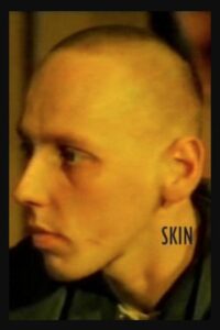 Skin 1995 one on netflix