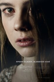 Spidse albuer, blødende knæ 2013 one on netflix