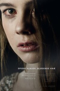 Spidse albuer, blødende knæ 2013 one on netflix